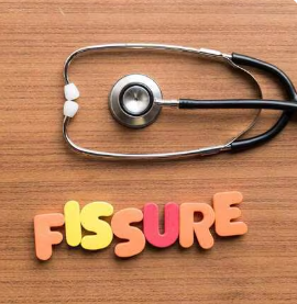Fissure Doctors