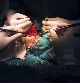 Hernia Treatment